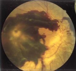 ���A�a�Ԗ���(�Ɏq�̏o��)