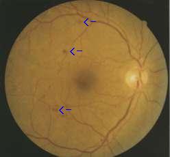 ���A�a�Ԗ���